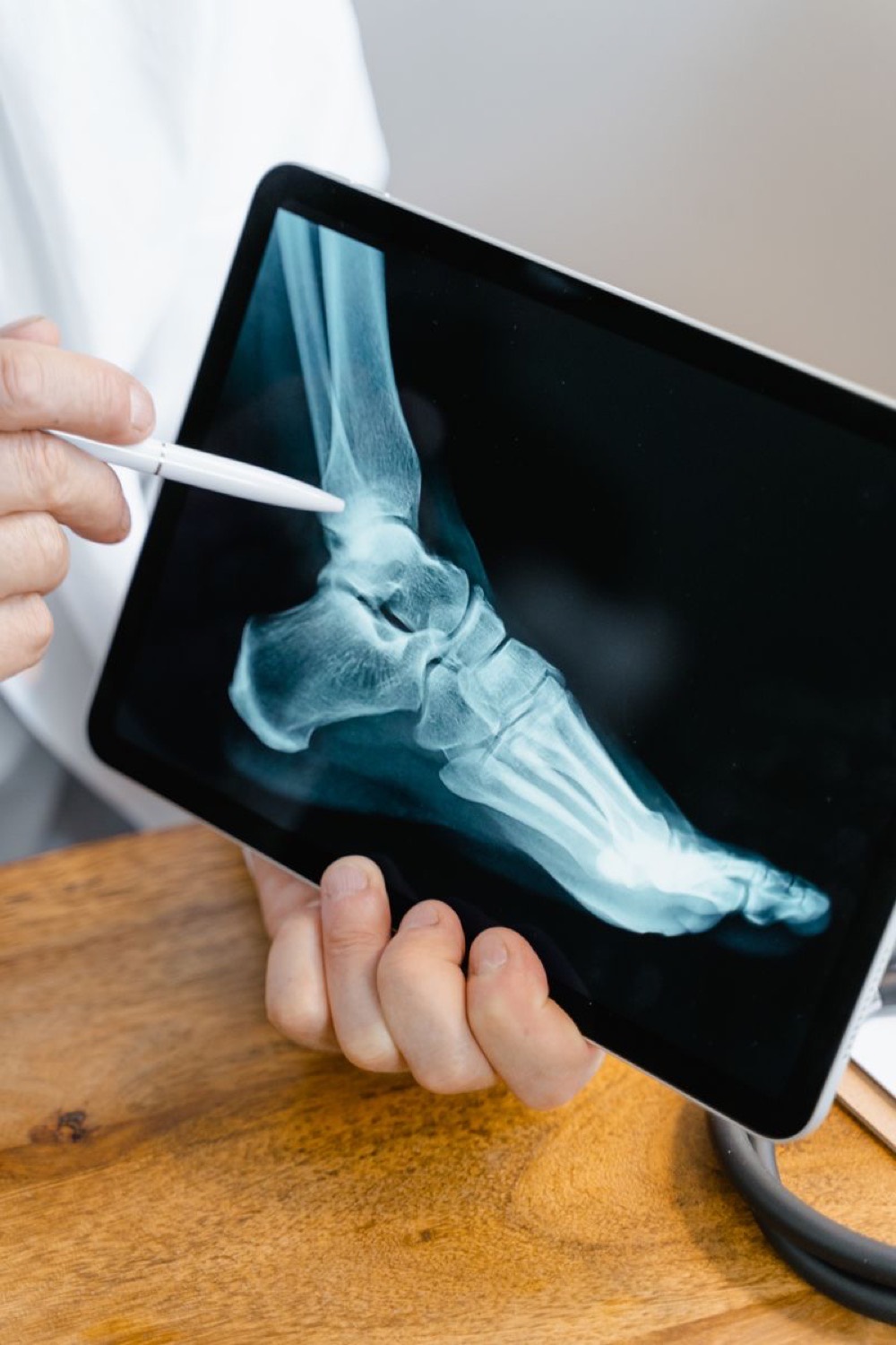 Merenje gustine kostiju u Nela Medica centru